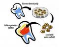 Adult stem cells could treat tooth loss