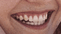 Crummett James F DDS
