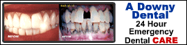 A Downy Dental