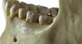 Dental calculus offers a window into the past, may unlock a 'microbial Pompeii'